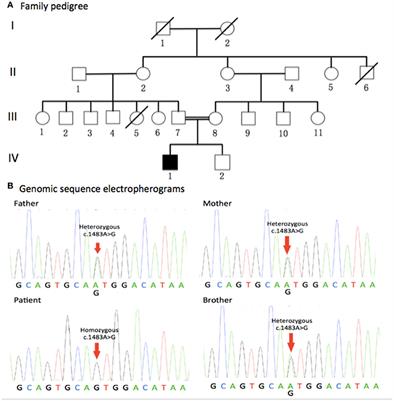 A Novel Missense Mutation of the DDHD1 Gene Associated with Juvenile Amyotrophic Lateral Sclerosis